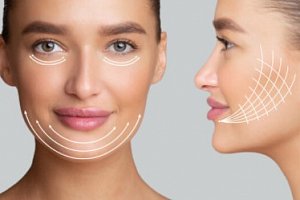 Facelift Training Course